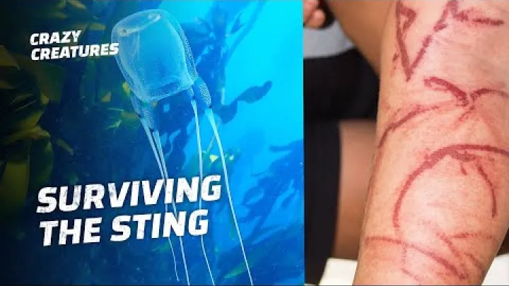 Preview image for the video "箱形水母可以在几分钟内致命".