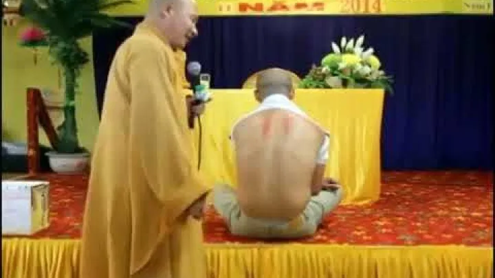 Preview image for the video "Cao Gio Massage - Cao Gio Coining - Vietnamese Scraping - Gua Sha".