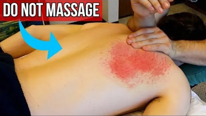Preview image for the video "7 MUST KNOW Contraindications of Massage Therapy".